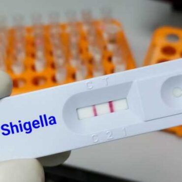 sgigella